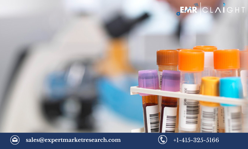 Carrier Screening Market Size, Share, Trends, Growth, Report and Forecast 2024-2032