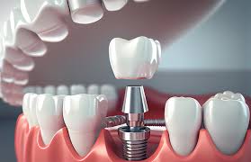 How to Choose the Best Dental Clinic