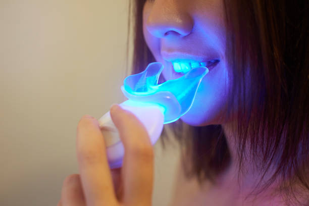 Experience Premier Teeth Whitening in Riyadh
